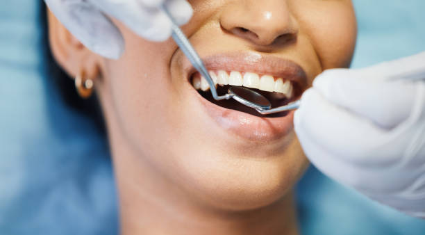Best Emergency Treatment for Dental Infections or Abscesses in Copperton, UT